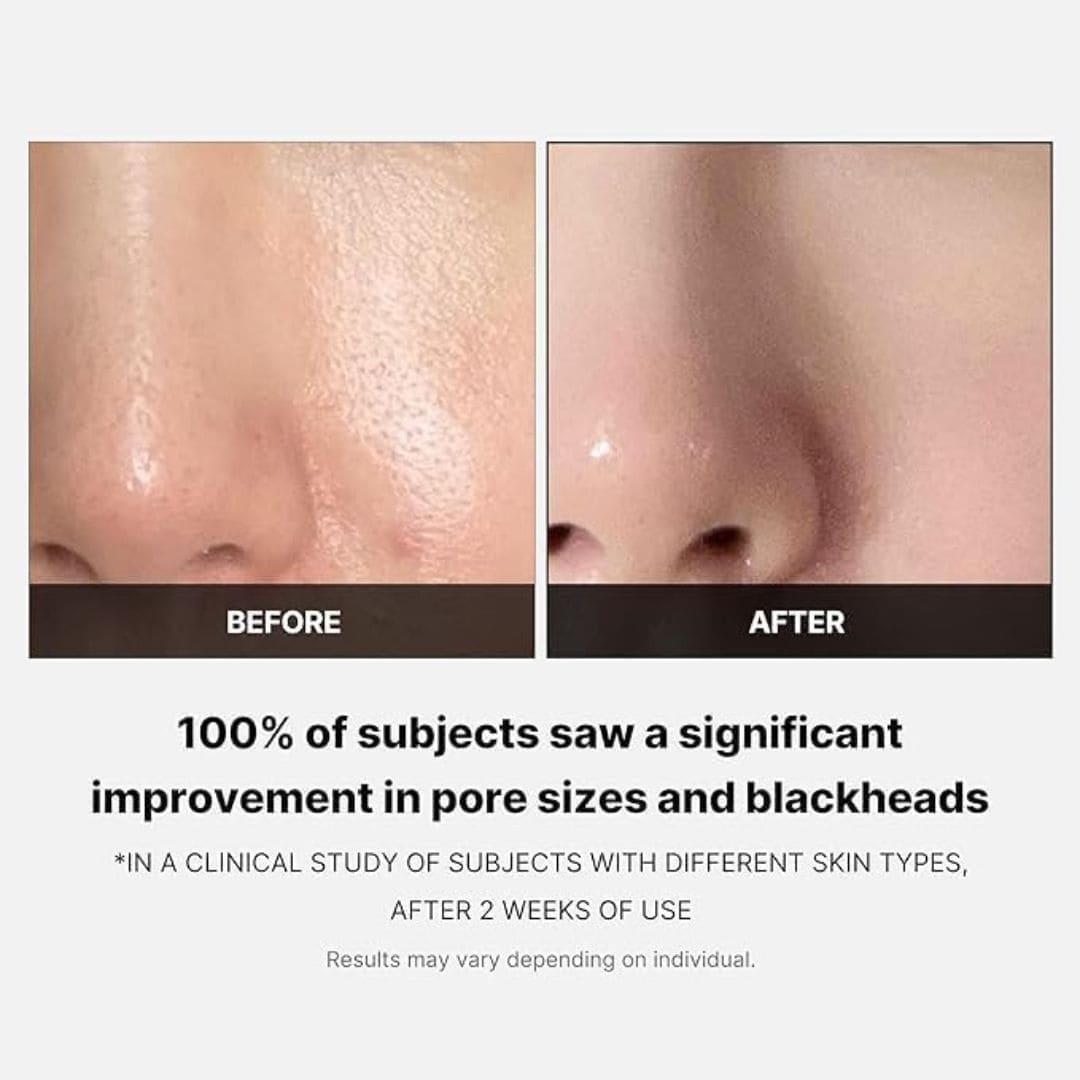 Medicube Zero Pore Pad 2.0 70pads by Harlequin Chestnut