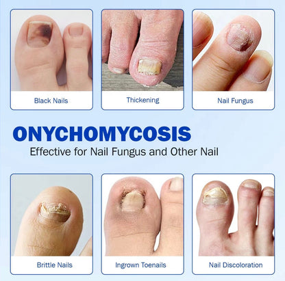 FungaFix Nail Patches by V.I.P Digital Presence