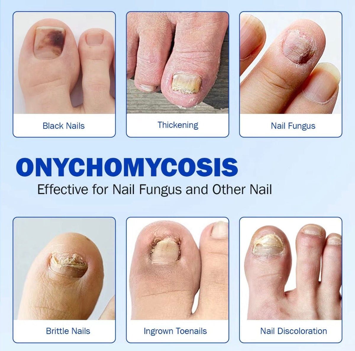 FungaFix Nail Patches by V.I.P Digital Presence