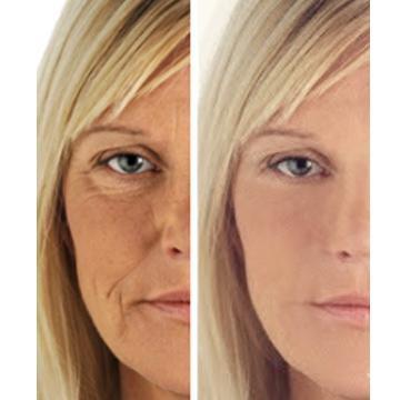 Age Perfect: Night Repair Cream + Vitamin C+ Serum by Hyperion