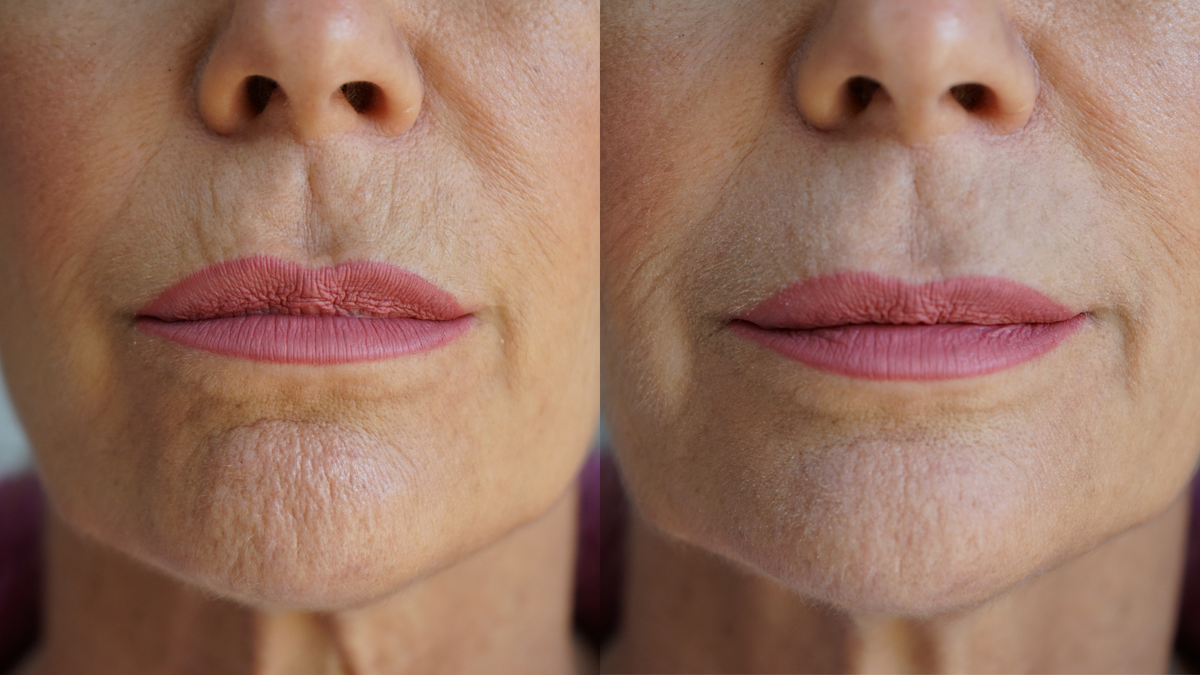 Ageless Lip and Line Filler – view 6