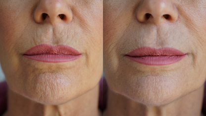 Ageless Lip and Line Filler – view 6