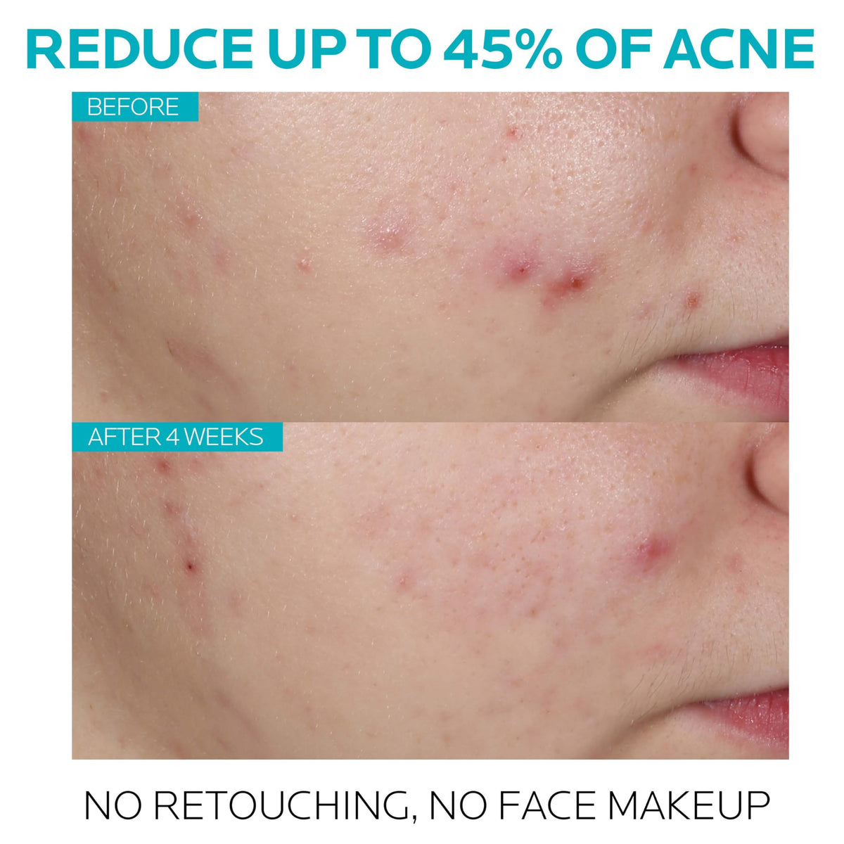 Effaclar serum – view 3
