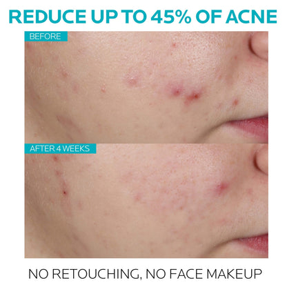 Effaclar serum – view 3
