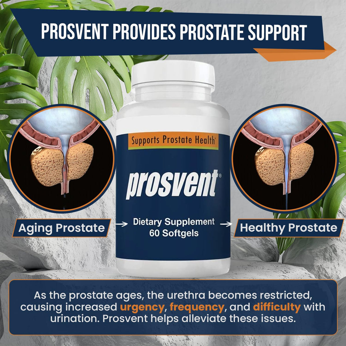 Prosvent Advanced Men's Prostate Support Natural Supplement 60 softgels by Shahmori