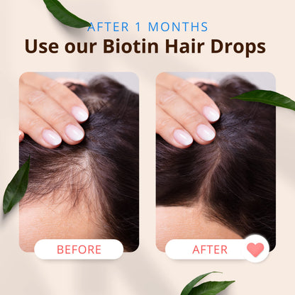 Morfose Hair Serum 50ml - Nourishing Treatment | Smooth & Shine by Beauty Care Bag