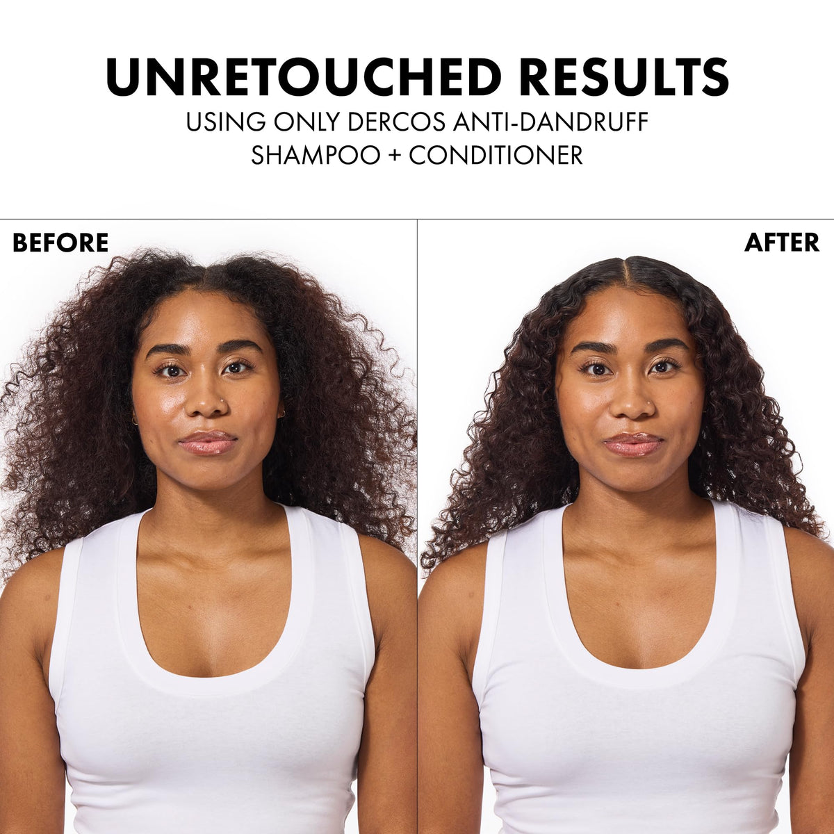 Vichy Dercos anti-dandruff shampoo – view 15