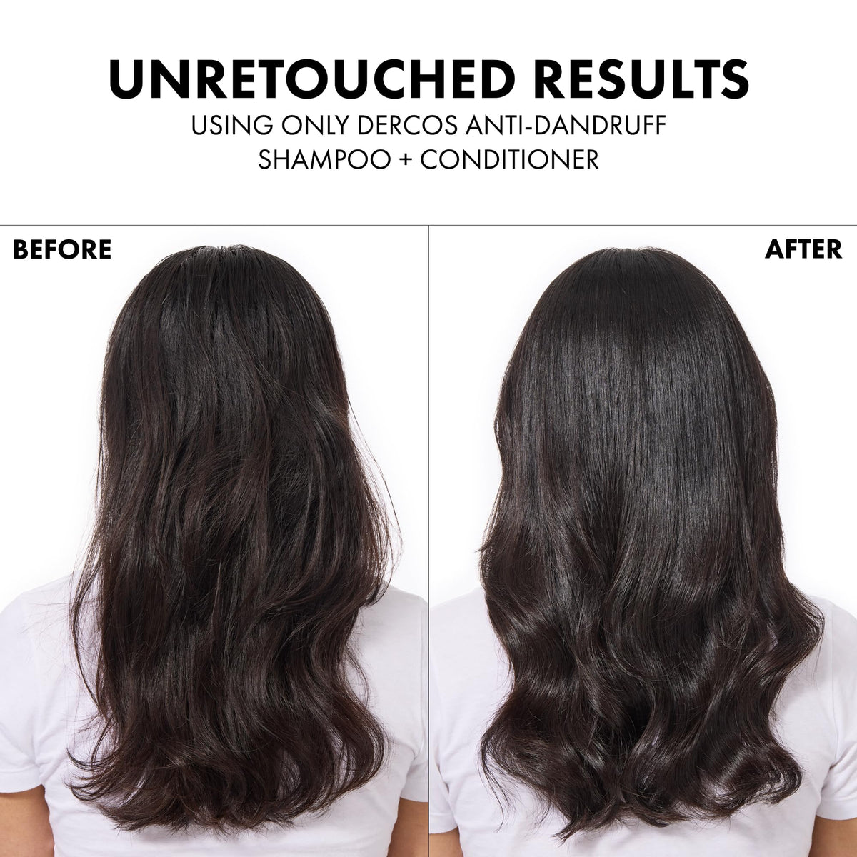 Vichy Dercos anti-dandruff shampoo – view 16