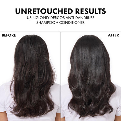 Vichy Dercos anti-dandruff shampoo – view 16