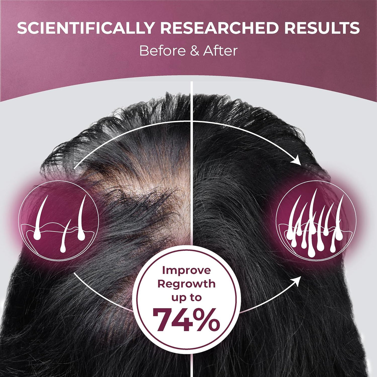 ReGrow Hair Growth Vitamins with Biotin, Hair Supplement by PureHealth Research by Shahmori