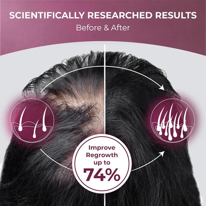 ReGrow Hair Growth Vitamins with Biotin, Hair Supplement by PureHealth Research by Shahmori
