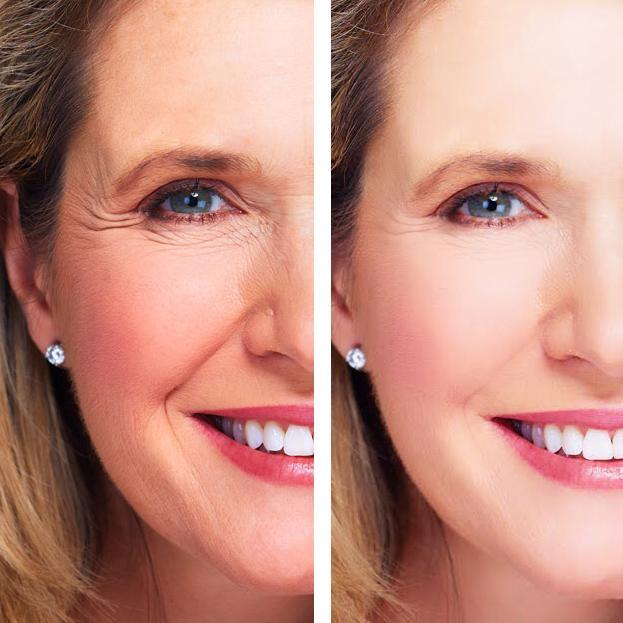 Age Perfect: Night Repair Cream + Vitamin C+ Serum by Hyperion