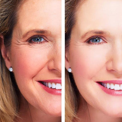 Age Perfect: Night Repair Cream + Vitamin C+ Serum by Hyperion