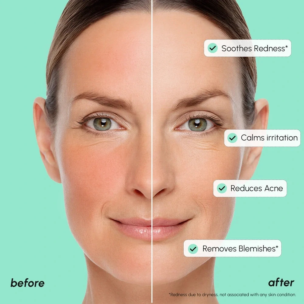 Azelaic acid serum – view 4
