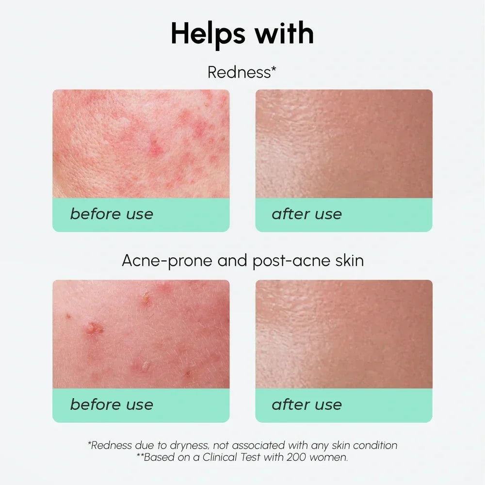 Azelaic acid serum – view 5