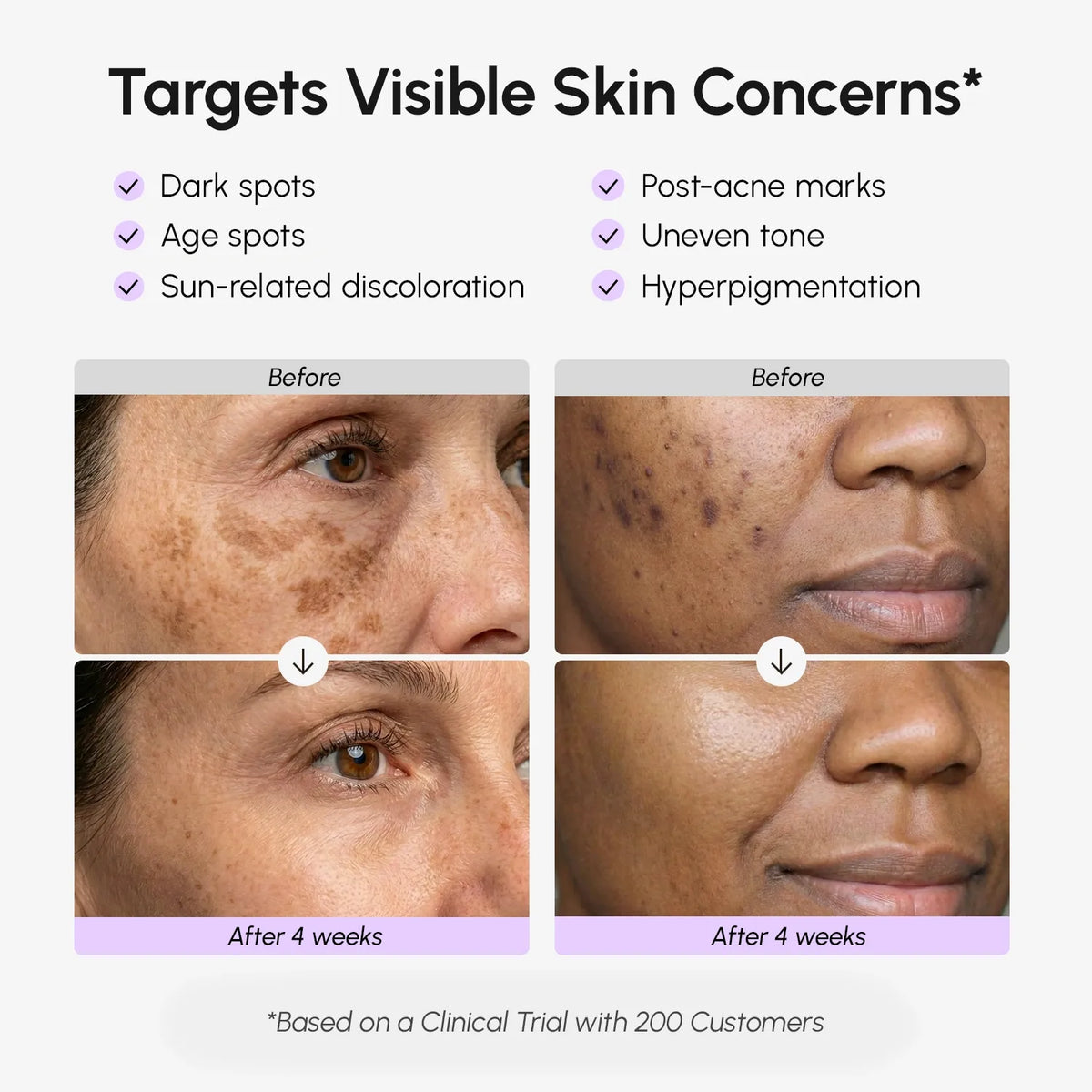 Face and body dark spot serum – view 3
