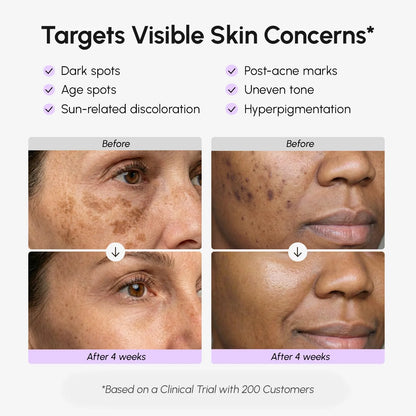 Face and body dark spot serum – view 3
