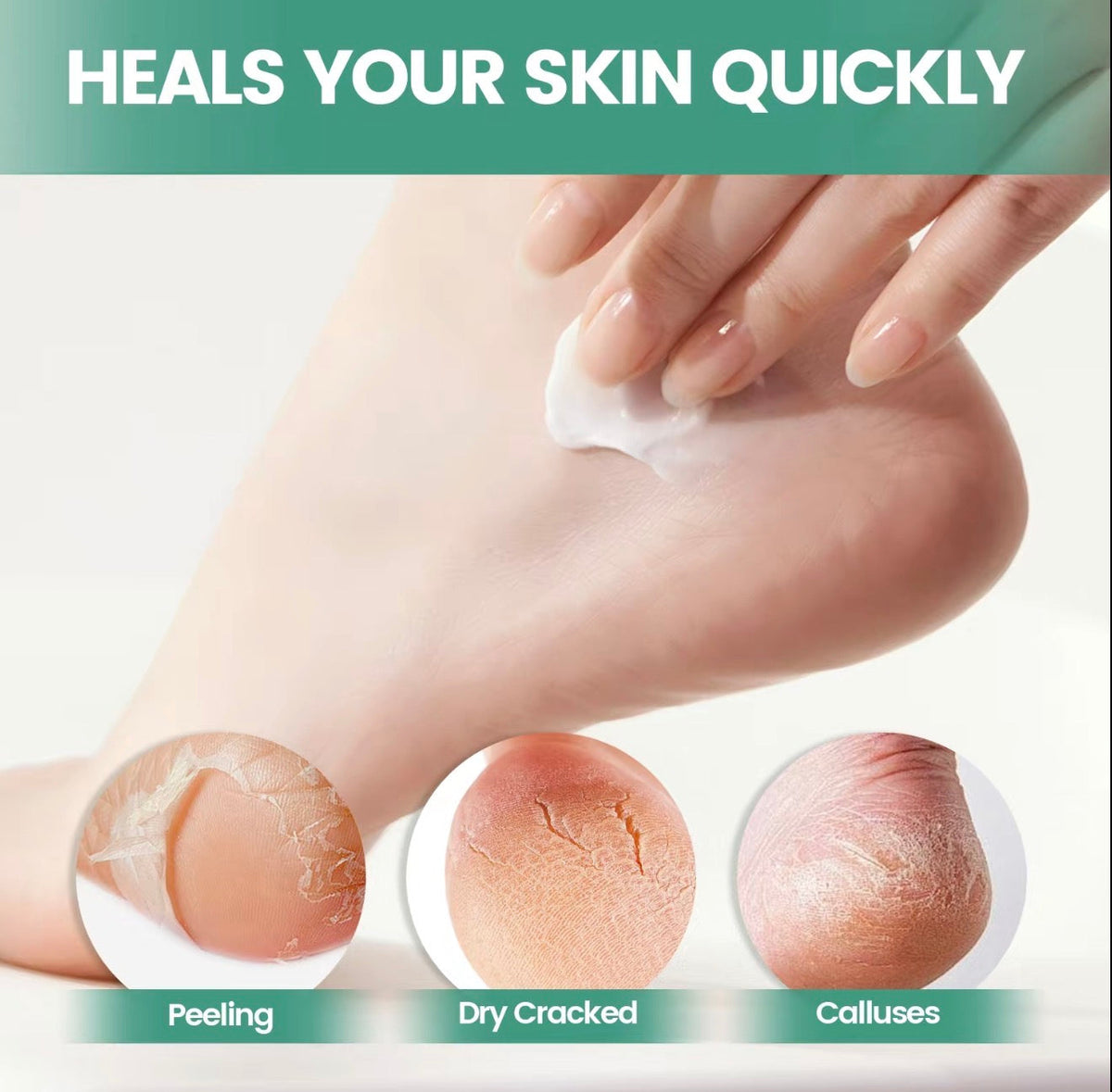 SkinCalm Repair Cream by V.I.P Digital Presence