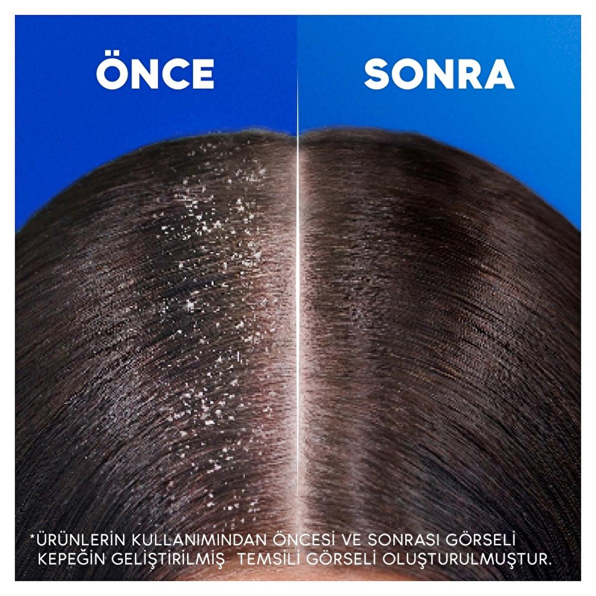 Head & Shoulders Shampoo for Women – view 7