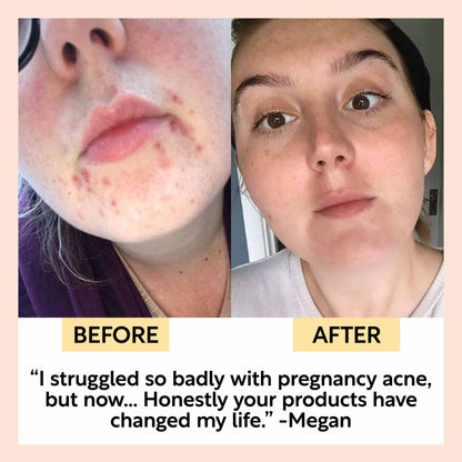 Cleanse, Tone + Moisturize Set by UpCircle