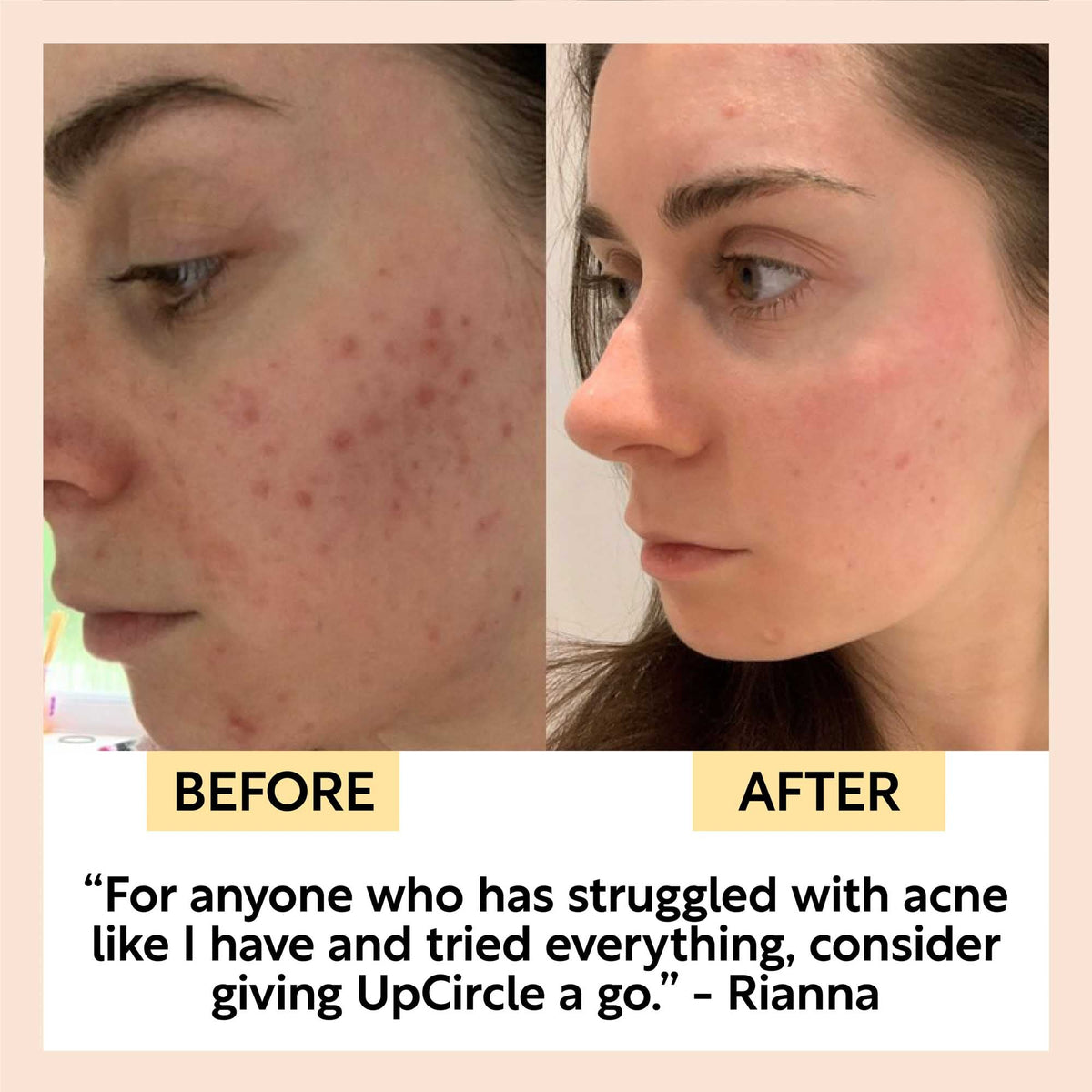 Cleanse, Tone + Moisturize Set by UpCircle