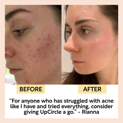 Travel-Size Skincare Bundle by UpCircle