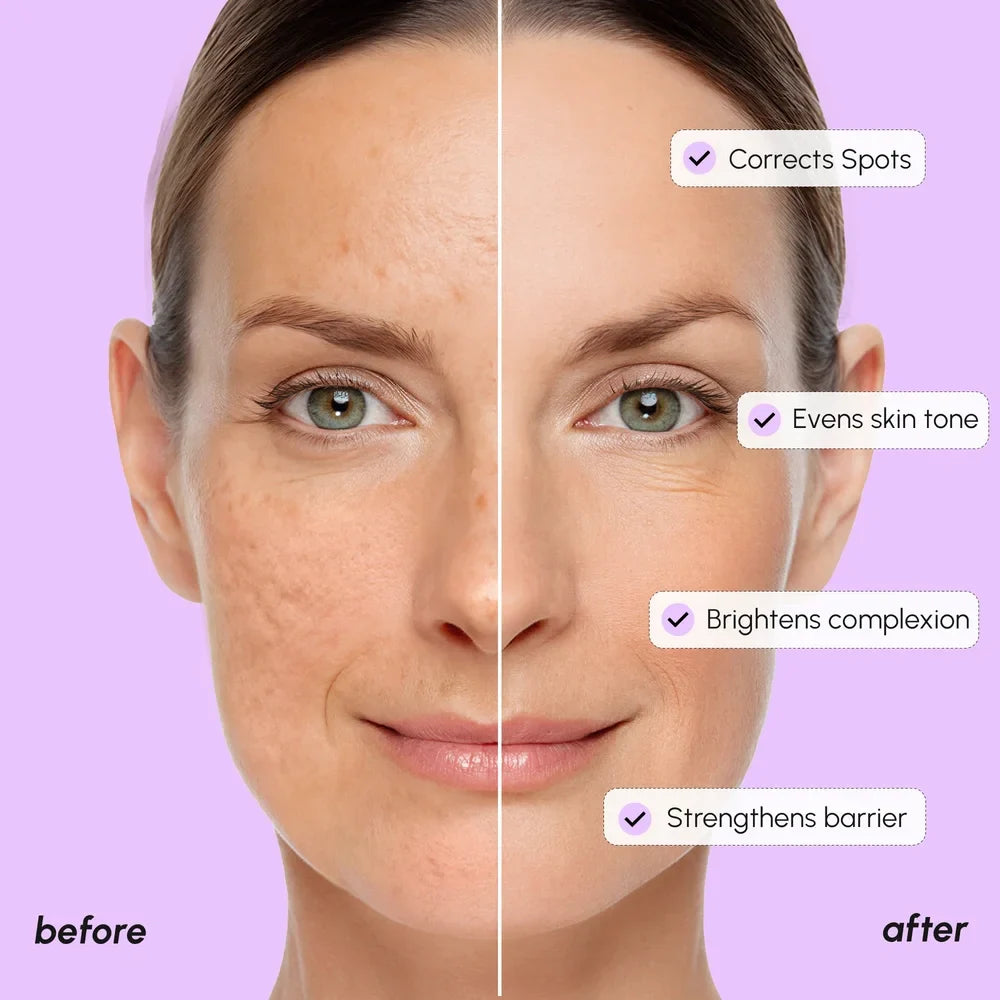 Dark spot corrector serum – view 4