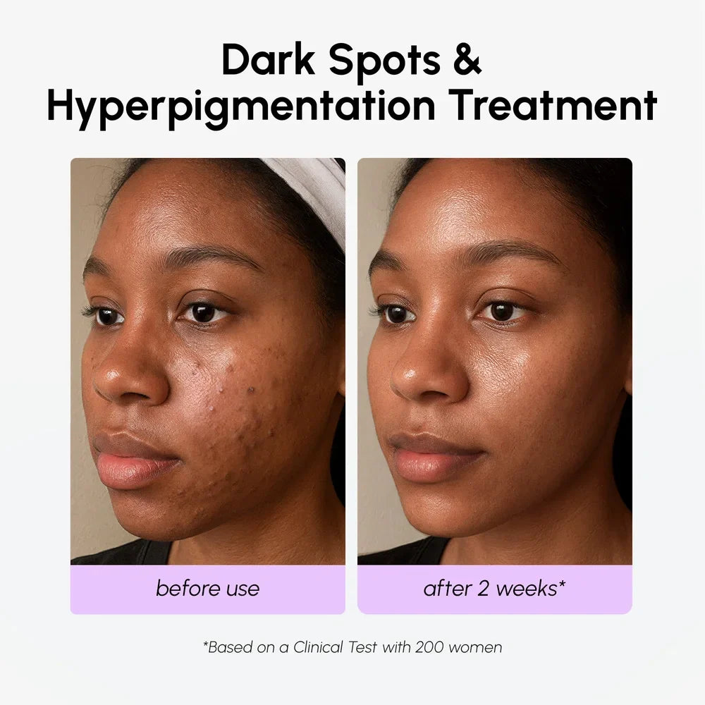 Dark spot corrector serum – view 5