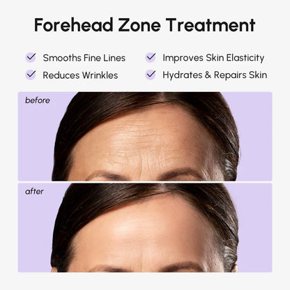 Anti-wrinkle forehead patches – view 3