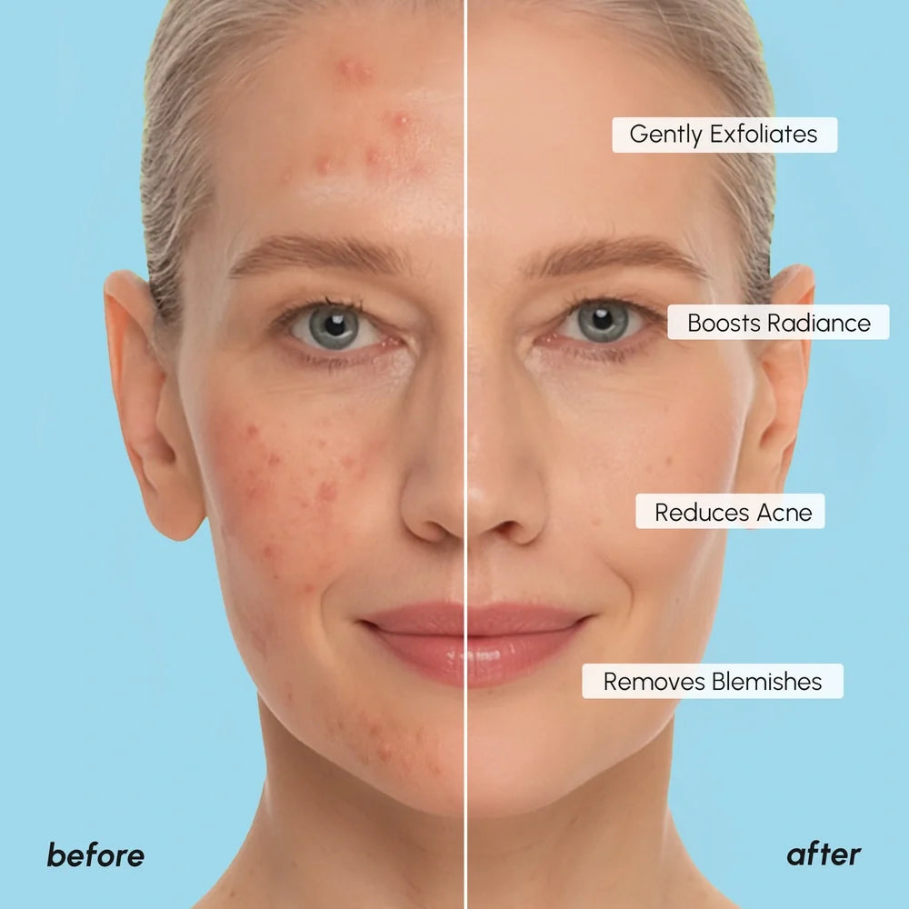 Glycolic acid toner pads – view 7