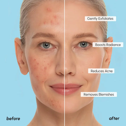 Glycolic acid toner pads – view 7