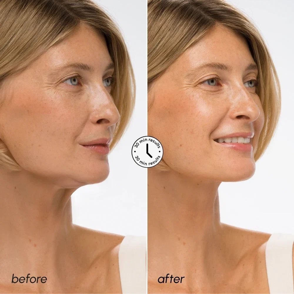 Hyaluronic acid V-line lifting mask – view 3
