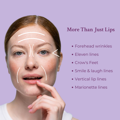 Ageless Lip and Line Filler – view 2