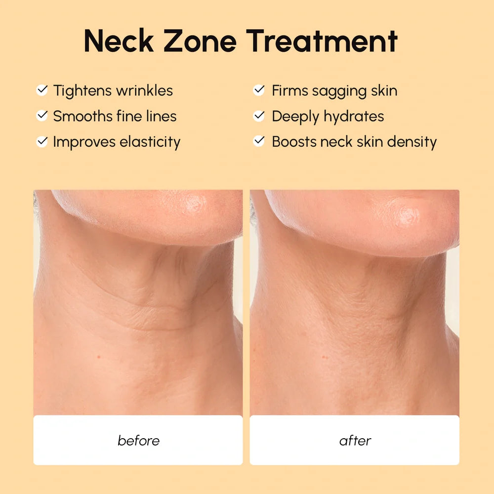 Lifting neck wrinkle patches – view 3