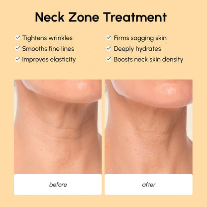 Lifting neck wrinkle patches – view 3