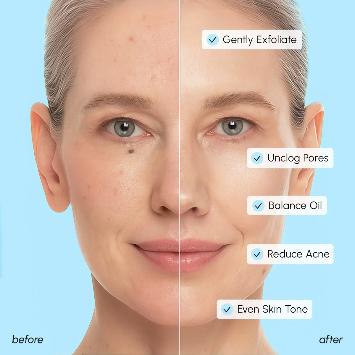 Glycolic and salicylic peel pads – view 5