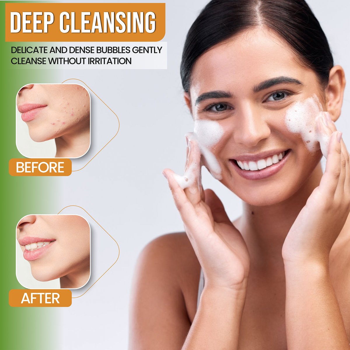 AMVital Turmeric Gel Cleanser by AMVital