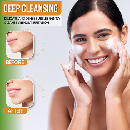 AMVital Turmeric Gel Cleanser by AMVital