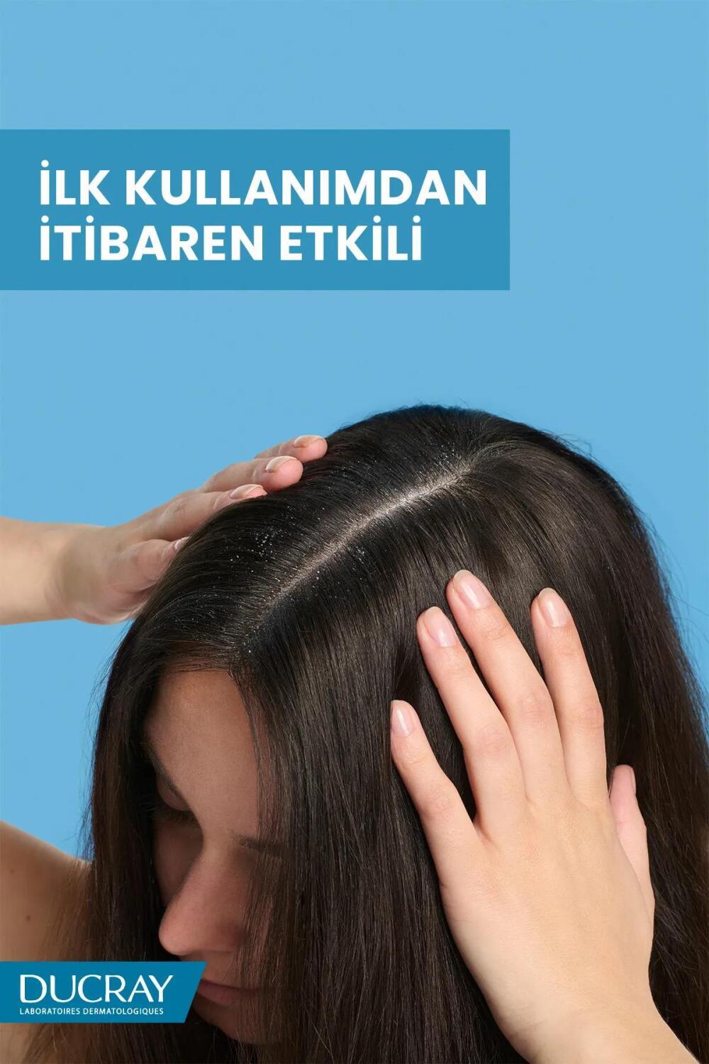 Ducray anti-dandruff shampoo – view 13