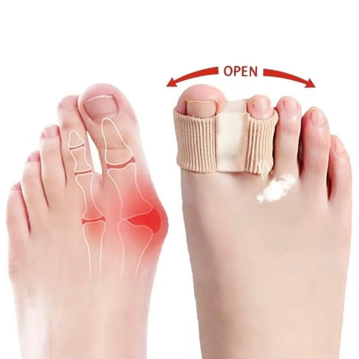 BunionEase Toe SeparatorsTorqelo.com