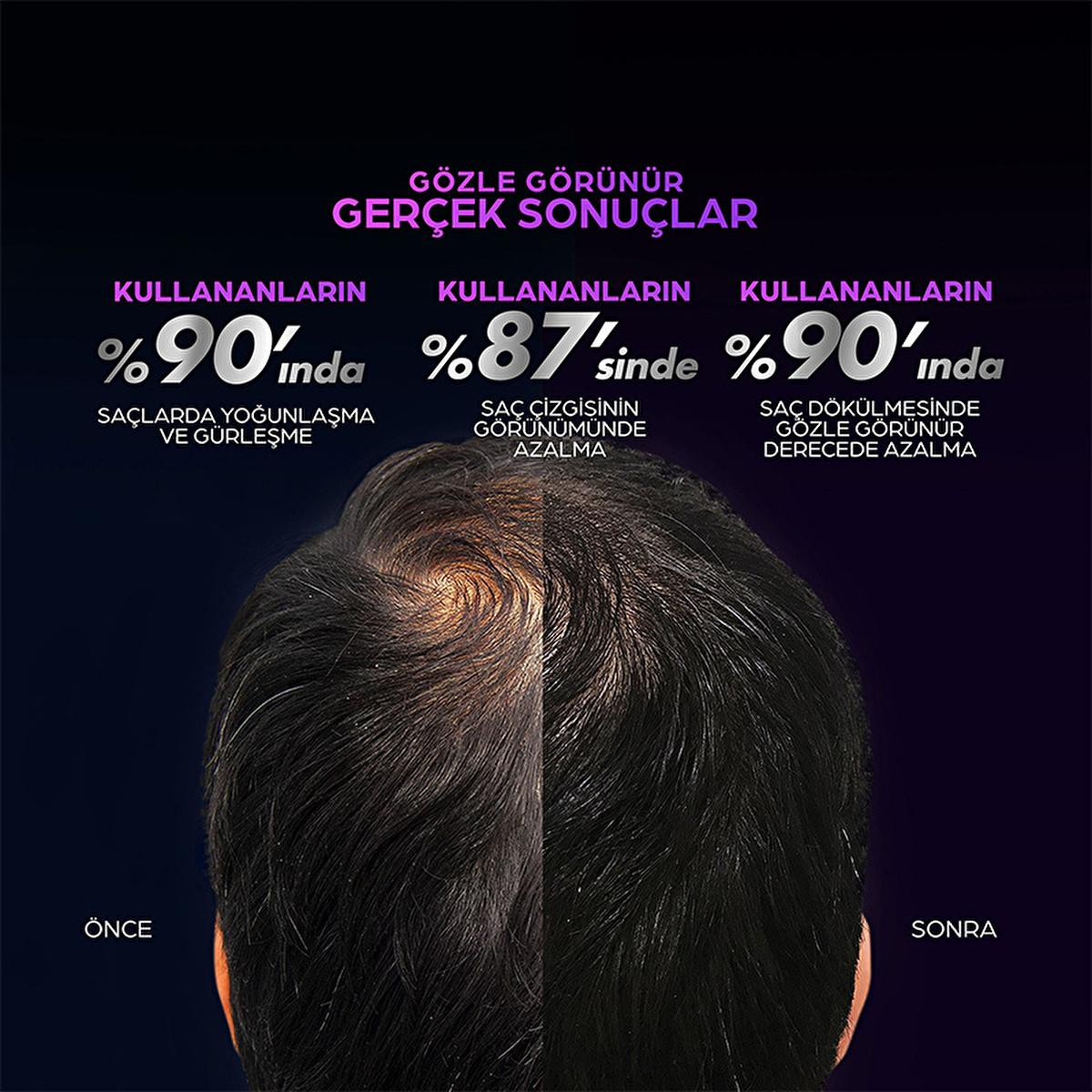 Clear Men Scalp Pro: Advanced Hair Growth Serum for Men - Clinically Proven Hair Loss Treatment - Strengthens & Thickens Hair for Increased Density by Beauty Care Bag