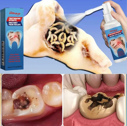 PainFree Oral Relief SprayTorqelo.com