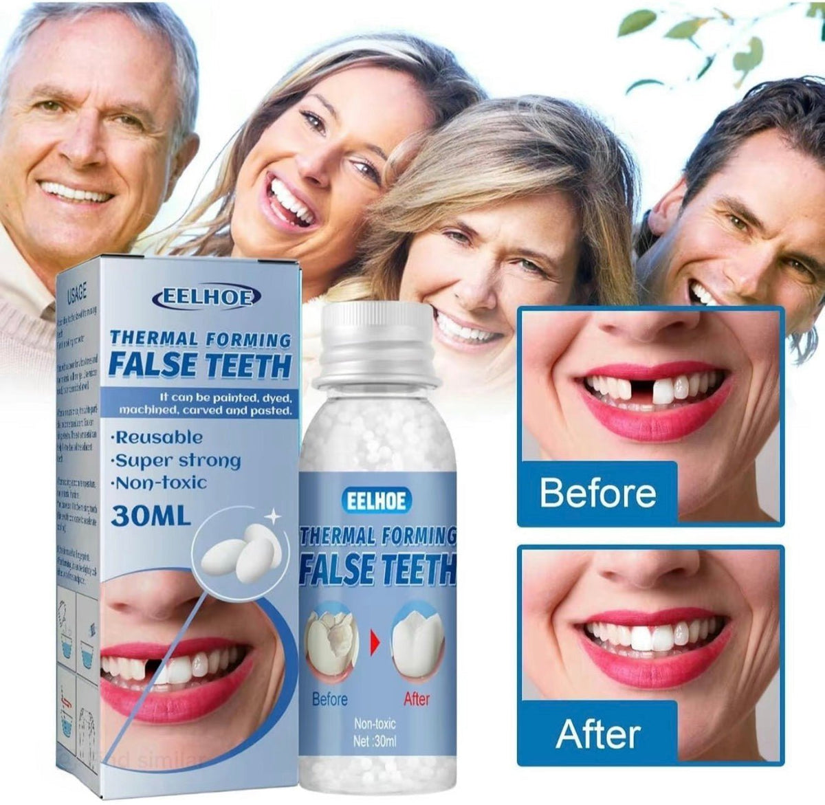 ToothMend KitTorqelo.com