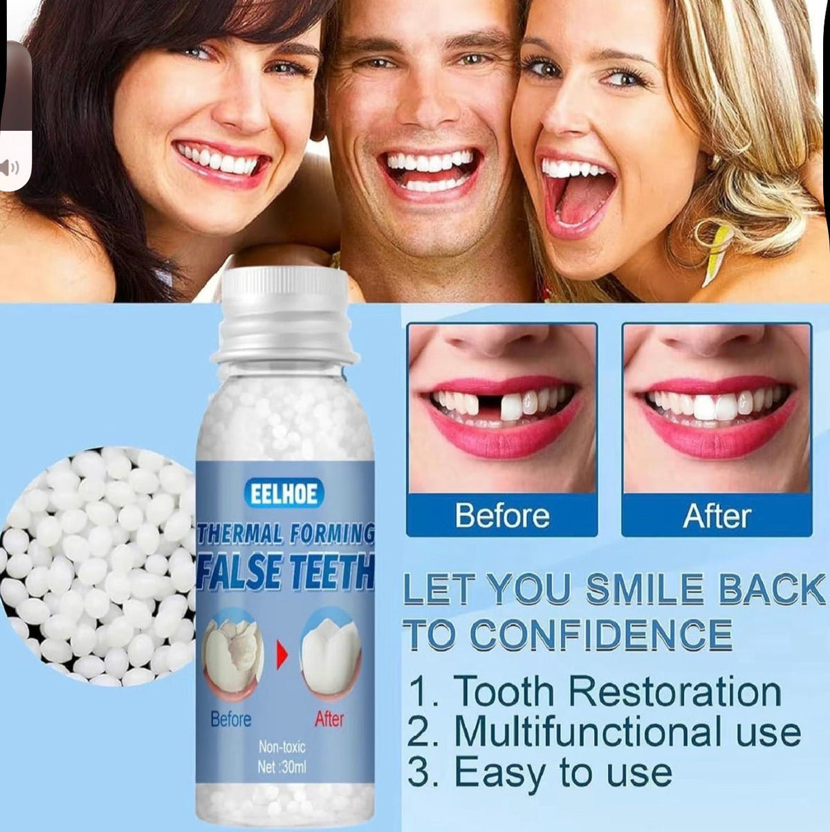 ToothMend KitTorqelo.com
