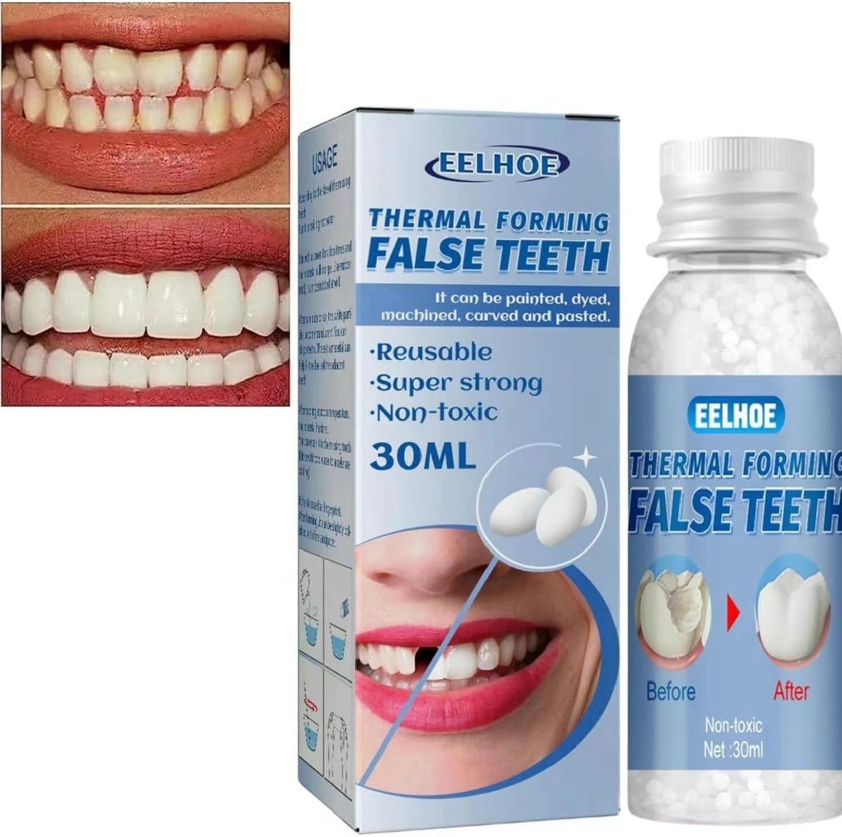 ToothMend KitTorqelo.com