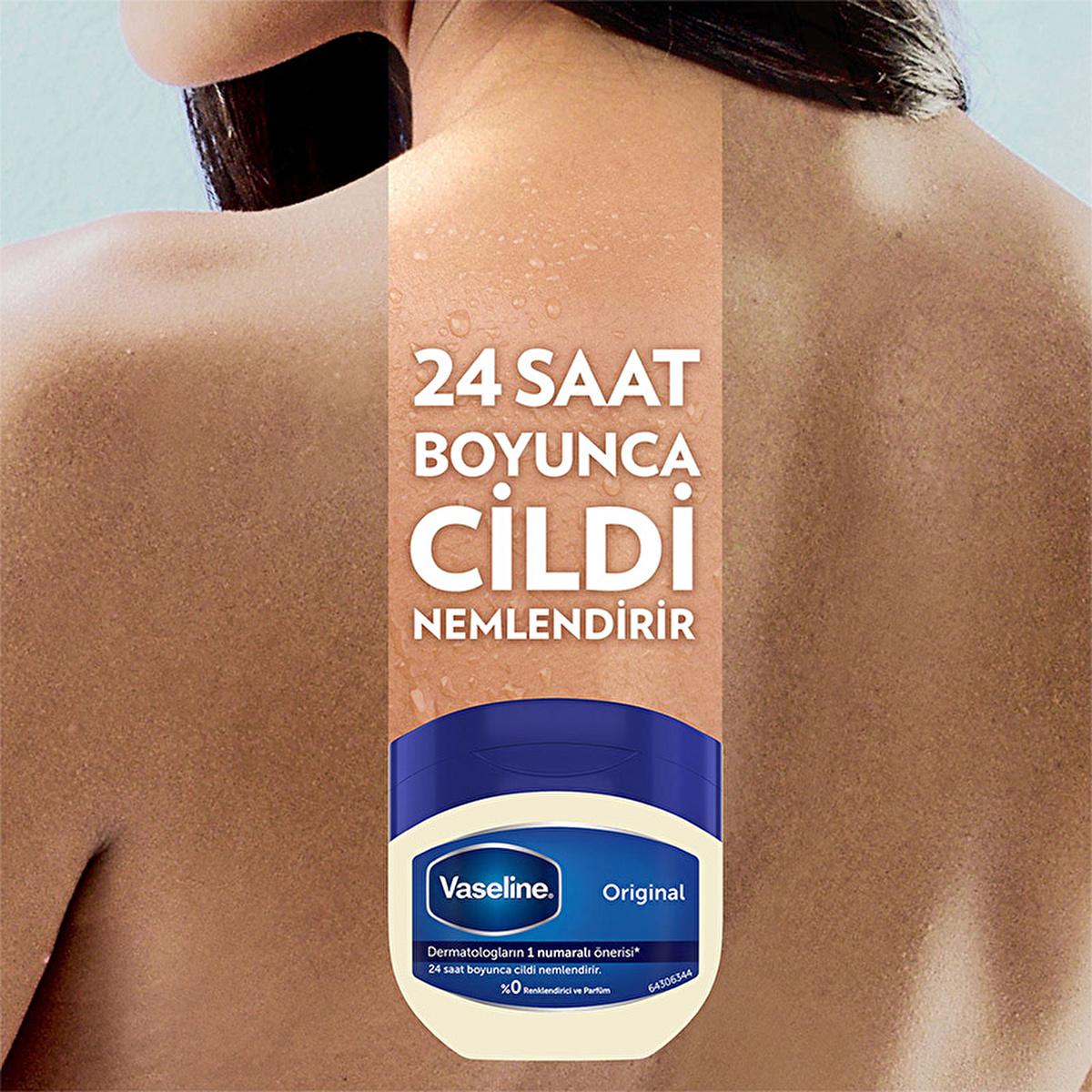 Vaseline Original Moisturizing Jelly - 24 Hour Hydration for Dry Skin, Hypoallergenic & Dermatologist-RecommendedMoisturizerTorqelo.com